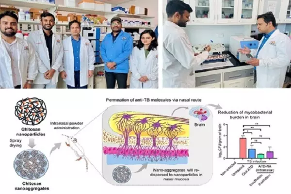 New nasal treatment cuts TB bacteria in brain by 1,000 times