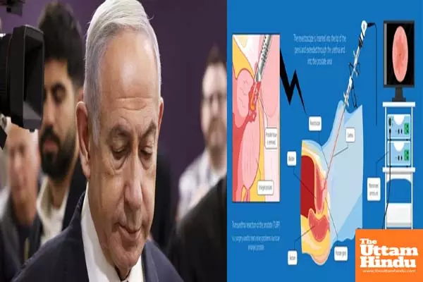 Israeli PM to undergo prostate removal surgery