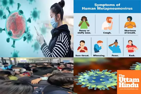 Experts say HMPV infection causes mild flu-like symptoms, no cause for alarm