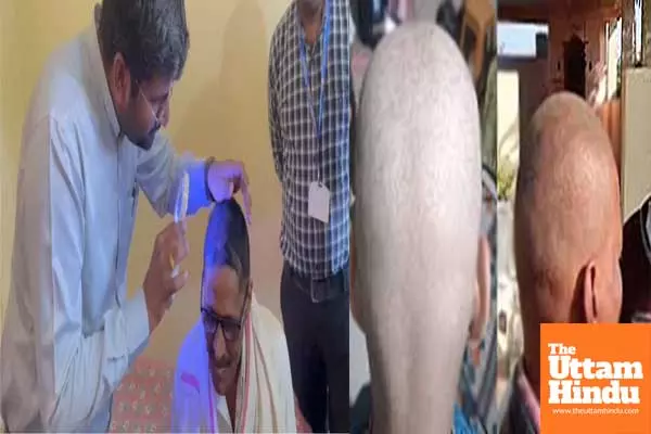 Balding bombshell: Maharashtra villages hit by mysterious hair loss epidemic!