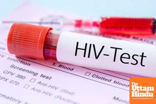 Global diagnosed HIV prevalence to reach over 2.2 mn in 2033: Report