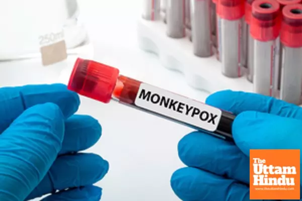 Monkeypox cases in Zambia hit seven