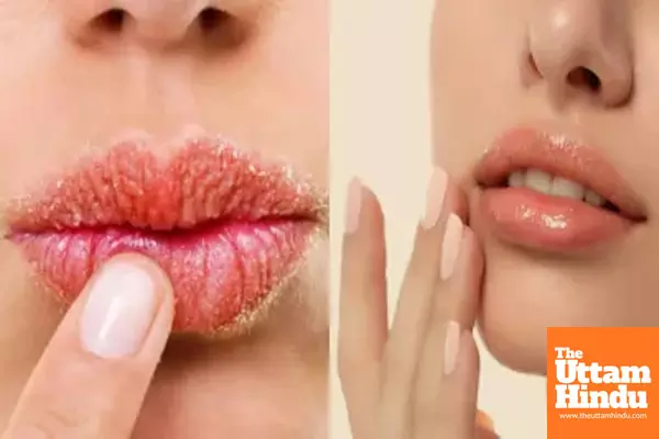 Pamper your lips with homemade lip gloss