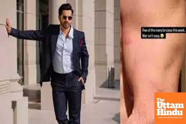 Varun Dhawan showcases ‘few of the many bruises’ he sustained